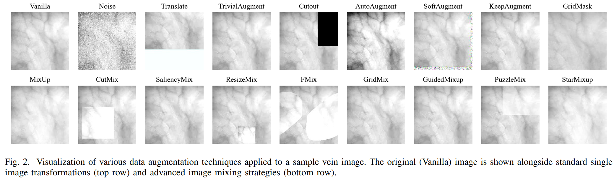 Visual examples of augmentation methods